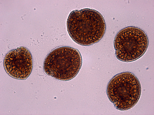 Gambierdiscus under a microscope, the cause of ciguatera poisoning.